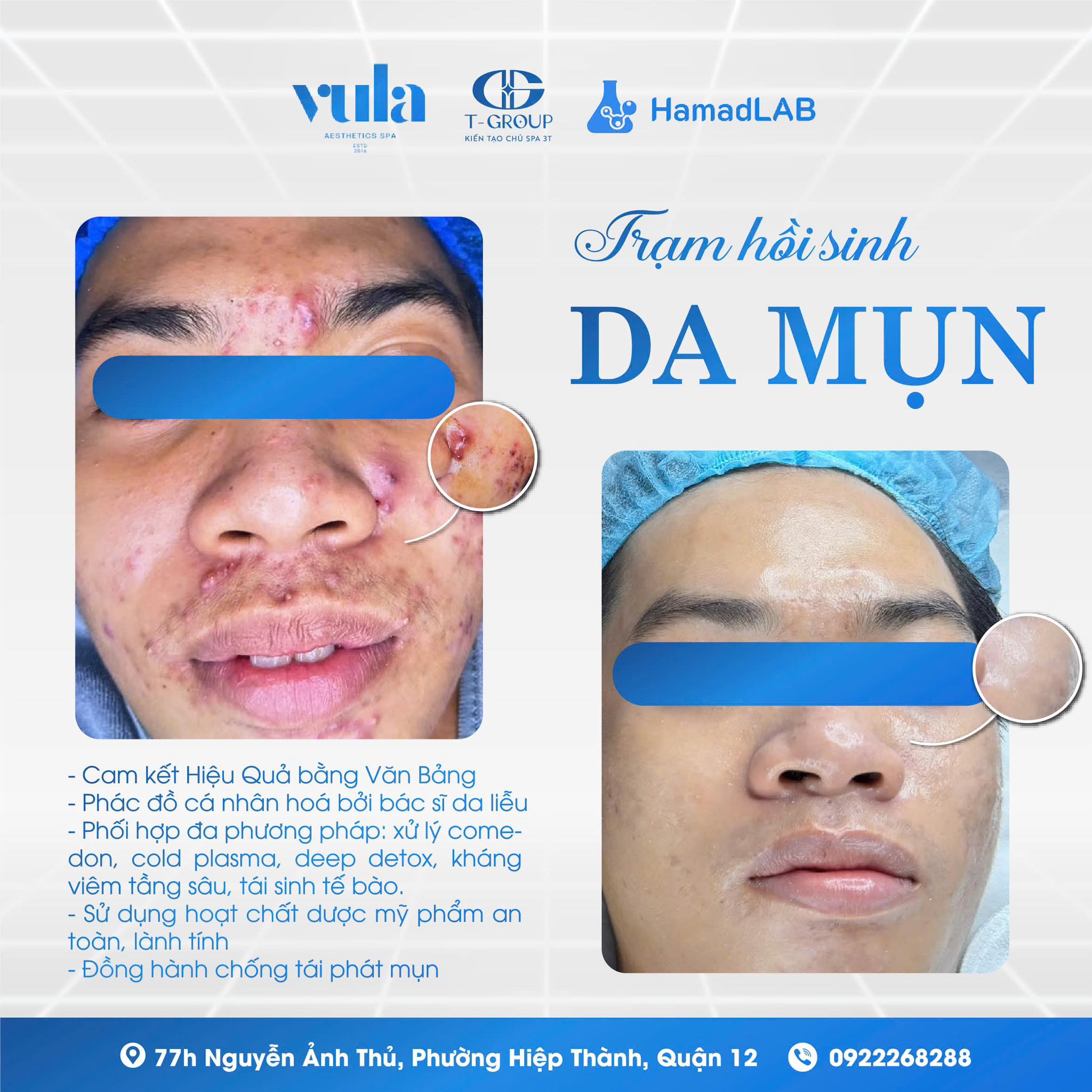 Hình ảnh trước sau